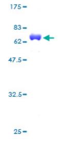 SDS-PAGE (CKB-1391H).jpg